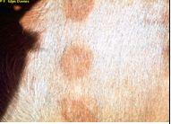 Early skin lesions
