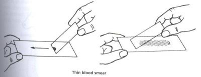 Glass slides for making blood smears