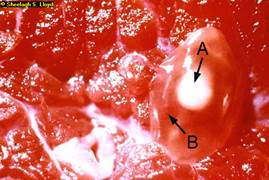 Tapeworm cyst
